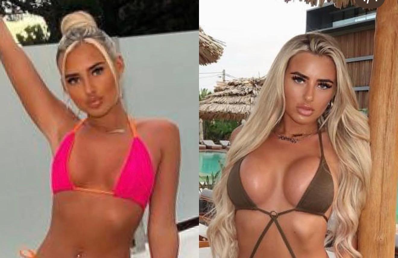Breast augmentation before and after result 1
