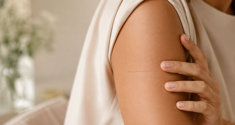Scar treatments at Harley Elite Group