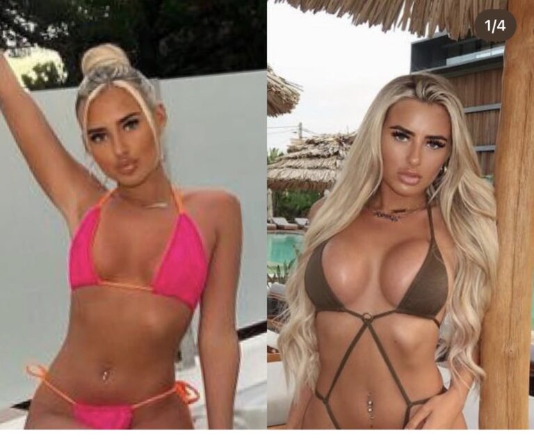 Read more about the article Understanding Breast Reduction Surgery