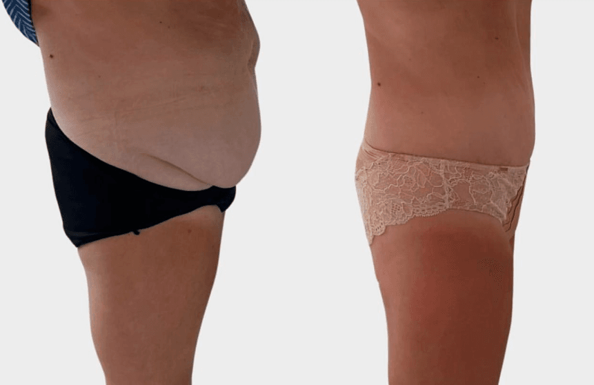 image_2025-02-03_113845157