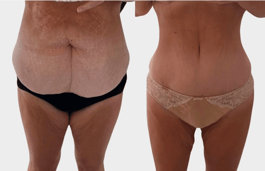 image_2025-02-03_113903432