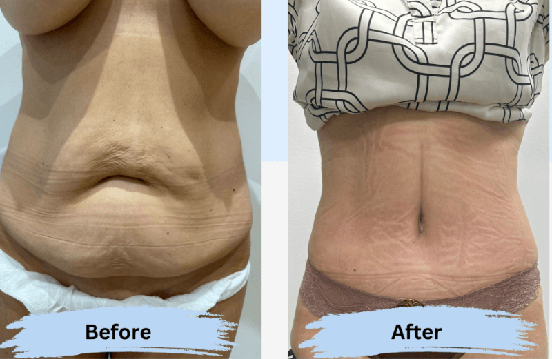 image_2025-02-03_114041997